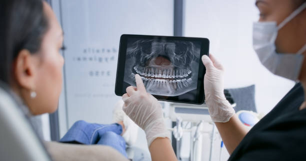 Licensed Tooth Extraction service in Naples, FL - Smile Center Dentistry